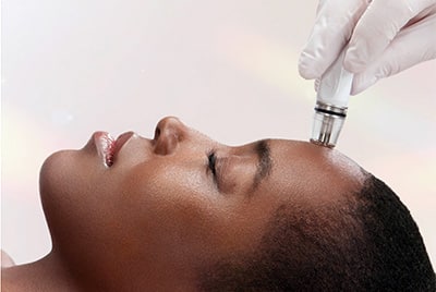 diamondglow-facial Sirius Med Spa DiamondGlow facial
