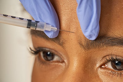 fillers Sirius Med Spa Botox and fillers