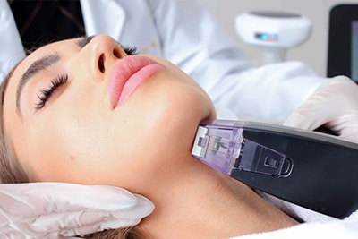 morpheus8needling Sirius Med Spa Morpheus8 Microneedling