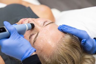 exion Sirius Med Spa Upneeq eye lift